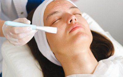 5 Ways to Reduce Dark Spots on Your Skin
