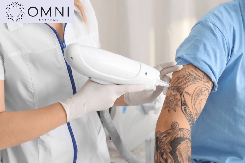 Laser Tattoo removal